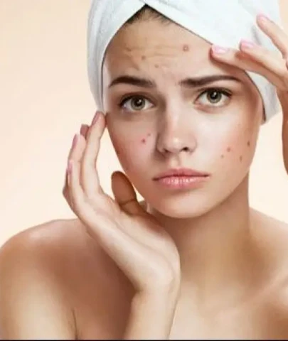 Evde Kolayca Yapabileceğiniz Yara İzlerini Gideren Doğal Kozmetik Ürün!