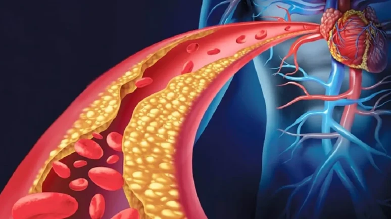 “İlaç Gibi Etki: 10 Günde Kolesterolü Dengeleyen Doğal Gıda”